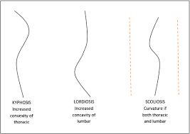 Solved A Compare The Abnormal Curvatures Associated With