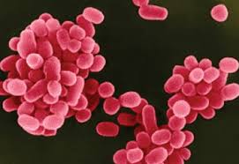 People with chronic q fever often develop an infection of one or more heart valves (called endocarditis). Fiebre Q Se Puede Detectar Mediante Amplificacion De Acidos Nucleicos Microbiologia Mobile Labmedica Es