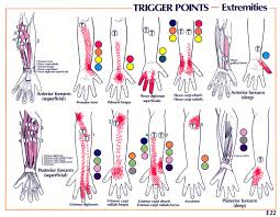 Trigger Point Referral Patterns Balance In Motion Bodywork