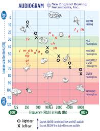 how to understand hearing loss audiograms the baha blog