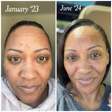 Is the Boogie Micro-Mist Saline Inhaler in your medicine cabinet?