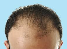 Short hairstyles for thin hair. Advice For Men How To Get A Haircut To Flatter Thinning Hair