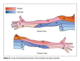 Observed Patterns Of Cervical Radiculopathy Chiropractic