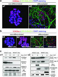 The Distribution Pattern Of H3k9ac And The Levels Of Histone Related Download Scientific Diagram