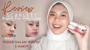 REVIEW SCARLETT WHITENING BRIGHTLY EVER AFTER DAY & NIGHT CREAM |GLOW  WHITENING GLISTENING TERBARU
