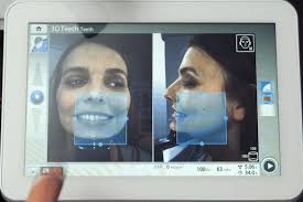 Cone Beam Imaging for Chiropractic