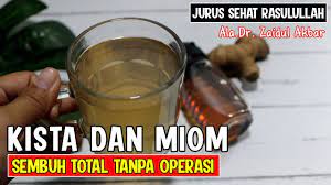 Obat herbal miom zaidul akbar. Cara Mengobati Miom Dan Kista Secara Alami Ala Dr Zaidul Akbar Sehat Tube Youtube