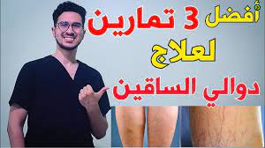شرب كميات كبيرة من الماء يقلل الام المغص المرارى لدى الكثير من المرضى لكن ذلك لا. Ø¹Ù„Ø§Ø¬ Ø¯ÙˆØ§Ù„Ù‰ Ø§Ù„Ø³Ø§Ù‚ÙŠÙ† ØªØ®Ù„Øµ Ù…Ù† Ù…Ø´ÙƒÙ„Ø© Ø§Ù„Ø¯ÙˆØ§Ù„Ù‰ Ù†Ù‡Ø§Ø¦ÙŠØ§ Varicose Veins Treatment Youtube