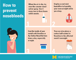 How To Stop A Nosebleed: 10 Tips For Stopping A Bloody Nose