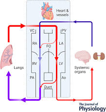 Image result for Delayed Transition from Fetal Circulation