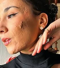 Maia Gray (@its_just_acne) • Threads, Say more