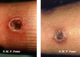 This really works to your satisfaction. Brown Recluse Spider Entomology