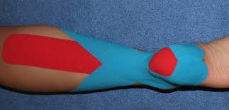 Image result for Taping for Soleus and Achilles