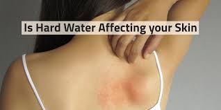 Getting Rashes Every Time You Shower Here S The Reason And Solution