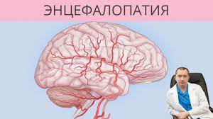 Энцефалопатия — это дистрофическое поражение мозговой ткани. Encefalopatiya Ot Chego S Vozrastom Razvivaetsya Encefalopatiya Youtube