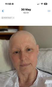 Hair growth after chemotherapy
