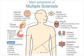 Symptoms of ms include muscle weakness (often in the hands and legs), tingling and burning sensations, numbness, chronic pain, coordination and balance problems, fatigue, vision problems, and difficulty with bladder control. Early Signs Of Multiple Sclerosis