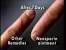 Neosporin Ointment