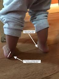Flat Feet In Children Thoughts From A Pt Gross Motor Momma Flat Feet Feet Easy Toddler Activities