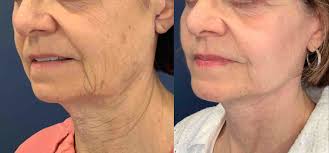 The incredible journey of Berwyn's JP Weber; Why we lost Wayne Sporting  Goods; Real estate rumblings in Radnor; Shipley grad's 'Wild Life'; Claytor  Noone Plastic Surgery; Anti-aging medicine; Personalized test prep &