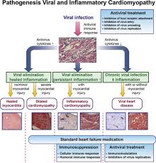 Magnani and dec diagnosis and treatment of myocarditis 877. Diagnosis Evaluation And Treatment Of Myocarditis In Children Pediatric Clinics