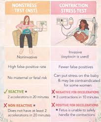 Image result for Contraction Stress Test