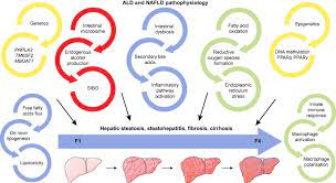 The Bidirectional Impacts Of Alcohol Consumption And The Metabolic Syndrome Cofactors For Progressive Fatty Liver Disease Journal Of Hepatology