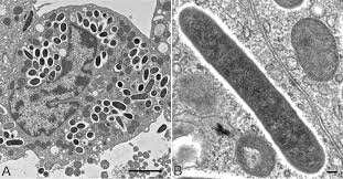 Image result for Rickettsiae