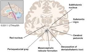 Image result for Cerebral Subcortex
