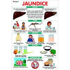 Chart No 93 Jaundice