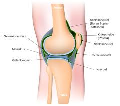 Ein anriss des innenmeniskus zählt zu den häufigsten sportverletzungen überhaupt. Meniskusriss Symptome Die Typischen Anzeichen Erkennen