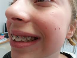 Профил за Д-р Светослава Коцева