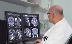 Image result for multiple sclerosis diagnosis