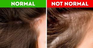 Because it is a temporary condition that returns to normal after birth. How Can I Stop Hair Loss After Being Pregnant Bs Home Fashion Beauty Magazine