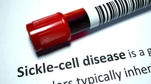 The most common form of scd found in north america is homozygous hbs disease (hbss), an autosomal recessive disorder. Hope Renews For Sickle Cell Disease Patients Biotech