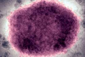 Monkeypox is a common animal disease of rodents, such as mice and squirrels, in the central and west african rainforests. Vt1bwfii4ch Fm