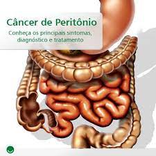 União do órgão intraperitoneal à parede do corpo. A C Camargo Cancer Center O Peritonio E Uma Membrana Que Reveste A Parte Interna Da Cavidade Abdominal E Recobre Orgaos Como O Estomago E O Intestino Veja Tudo O Que Voce Precisa