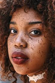 Fashion Documenting Street Style In Johannesburg South Africa The Photography Of Cedric Nzaka Beautiful Freckles Woman Face Face Photography