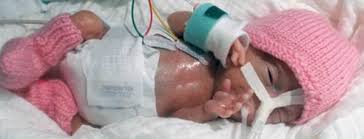 Além disso, ele segue definindo seus traços. Conheca O Menor Bebe Do Mundo Emilia Nasceu Com 0 22 Kg Noticias Que Vao Mudar O Mundo