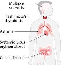 Autoimmune Diseases Health Topics Nutritionfacts Org