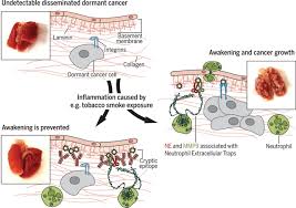 Cancer is the name for a group of more than 100 diseases in which cells begin to grow out of control. Neutrophil Extracellular Traps Produced During Inflammation Awaken Dormant Cancer Cells In Mice Science