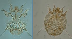 Image result for Sarcoptes scabiei life cycle