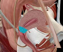 Find & download free graphic resources for human body organs. Anatomy And Physiology Internal Female Reproductive Anatomy