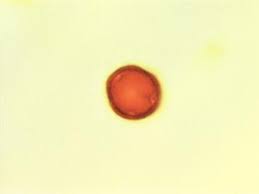 Image result for Trilepisium madagascariense