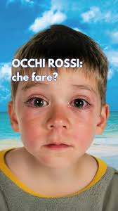 Occhi rossi e vacanze, un’accoppiata frequente 👁️ 👁️ , #occhi #occhirossi  #oculista #oftalmologo #vacanze #bambiniinvacanza #vacanzeserene #mare  #piscina #sole