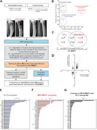 Oncotarget Osteolytic Cancer Cells Induce Vascular Axon