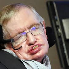 Cuál es la rara enfermedad que padecía Stephen Hawking?