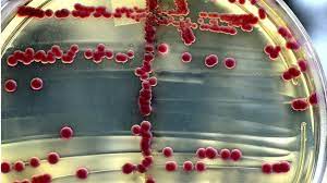 Bacteria That Resist Last Antibiotic Found In Uk Antibiotic Multiple Chemical Sensitivity Bacteria