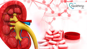 Image result for paraphimosis