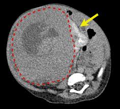 Pin On Excalibur Healthcare S Imaging Teleradiology Pins